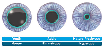 acuvue varifocal contact lenses